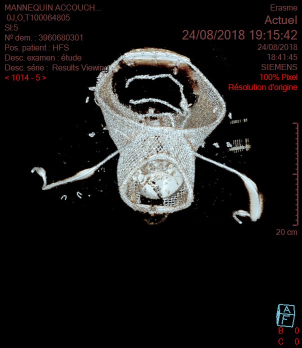 CT scan tridimensionnel de la machine de Madame du Coudray